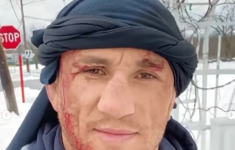 UFC-ov borac skočio u zaleđeno jezero: Završio je u bolnici