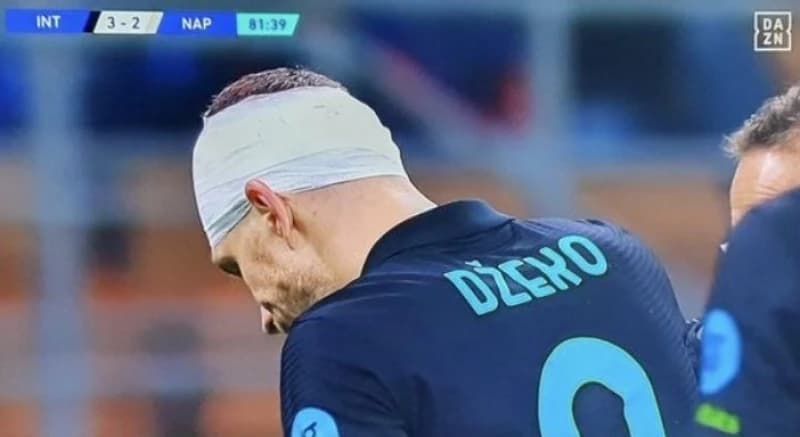 Džeki razbijena glava, Inter nanio prvi poraz Napoliju