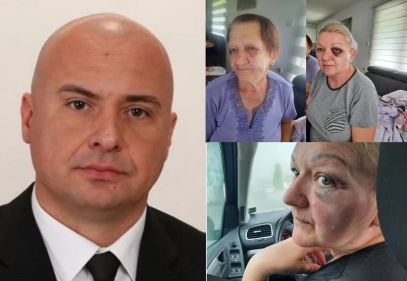 Vijećnik iz Stanara pretukao ženu i njenu kompletnu familiju: Samo sam se branio