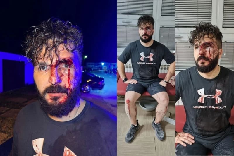 U Brčkom pretučen novinar Mirza Dervišević
