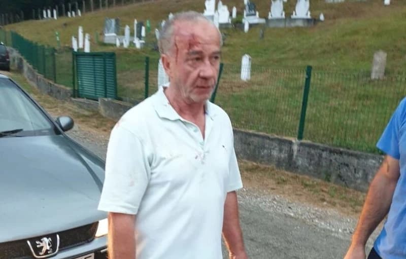 Feštali sa Dodikom i Trivić, pa vraćajući se pijani napali povratnika: "Onako 'nabrijani' pretukli bi i za disanje"