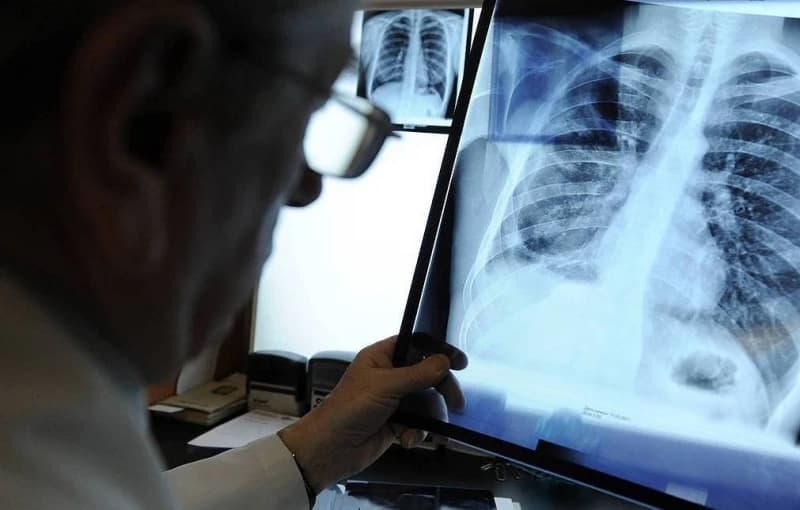 Savjeti italijanskog ljekara: Zadržite dah više od 10 sekundi i ako to možete uraditi bez kašljanja, nema infekcije