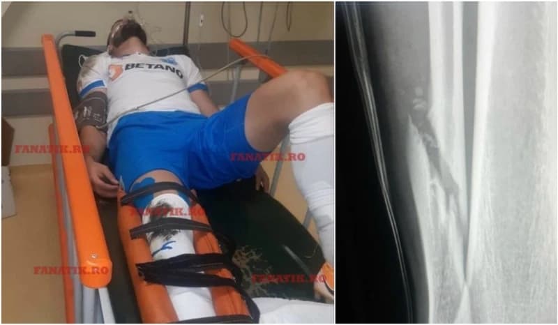 Potvrđeno: Elvir Koljić slomio nogu, pauzira minimalno tri mjeseca, navijači ispred bolnice